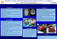 5423fbe9bb9e7bfd9ca17a35237fe795b38f64cd